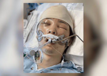 Unidentified man found with brain injury, Japanese currency in L.A.
