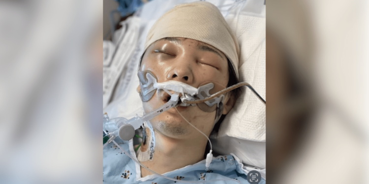 Unidentified man found with brain injury, Japanese currency in L.A.